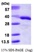 Human RACK1 protein, His tag. GTX68149-pro
