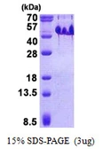 Human BASP1 protein, His tag. GTX68150-pro
