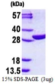 Human EMG1 protein, His tag. GTX68151-pro