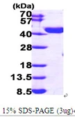 Human PECI protein, His tag. GTX68153-pro