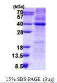 Human HAX1 protein, His tag. GTX68154-pro