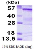 Human BAIAP2 protein, His tag. GTX68155-pro