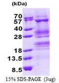 Human TADA3L protein, His tag. GTX68158-pro