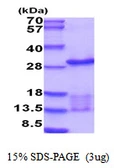 Human UBE2E3 protein, His tag. GTX68160-pro