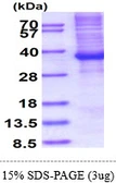 Human HOXB13 protein, His tag. GTX68161-pro
