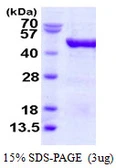 Human VAT1 protein, His tag. GTX68162-pro
