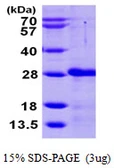 Human CIB2 protein, His tag. GTX68163-pro