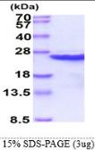 Human CIB1 protein, His tag. GTX68164-pro
