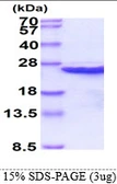 Human CIB1 protein, His tag. GTX68164-pro