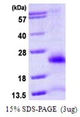 Human FAT10 protein, His tag. GTX68167-pro