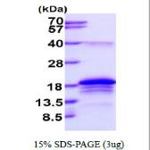 Human BATF protein, His tag. GTX68168-pro