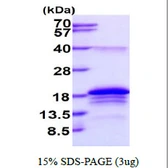 Human BATF protein, His tag. GTX68168-pro