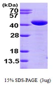 Human TXNL2 protein, His tag. GTX68169-pro