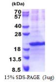 Human SIVA protein, His tag. GTX68176-pro