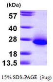 Human RCL protein, His tag. GTX68179-pro