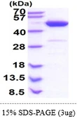 Human PAICS protein, His tag. GTX68180-pro