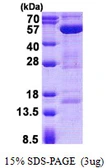 Human STAMBP protein, His tag. GTX68182-pro