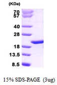 Human p23 protein. GTX68189-pro