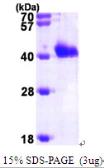 Human GIPC1 protein, His tag. GTX68191-pro