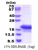Human ARPP19 protein, His tag. GTX68193-pro