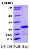 Human CPLX1 protein, His tag. GTX68195-pro