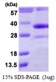 Human DHRS4 protein, His tag. GTX68198-pro