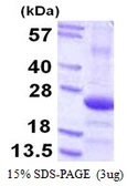 Human COPS8 protein, His tag. GTX68201-pro