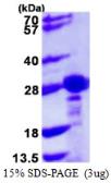 Human CBX1 / HP1 beta protein, His tag. GTX68205-pro