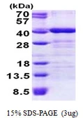 Human TOMM34 protein, His tag. GTX68206-pro