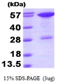 Human STIP1 protein, His tag. GTX68208-pro