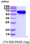 Human STIP1 protein. GTX68209-pro