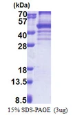 Human EBNA1BP2 protein, His tag. GTX68210-pro