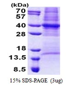 Human CSN6 protein, His tag. GTX68212-pro