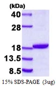 Human Destrin protein, His tag. GTX68218-pro