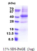 Human PIM2 protein, His tag. GTX68219-pro