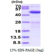Human ADRM1 protein, His tag. GTX68220-pro
