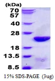Human UBE2C protein, His tag. GTX68222-pro