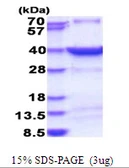 Human HSF2BP protein, His tag. GTX68223-pro