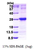 Human NUDT4 protein, His tag. GTX68230-pro