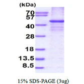 Human RASSF1 protein, His tag. GTX68233-pro