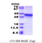 Human PROSC protein, His tag. GTX68235-pro