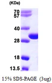 Human TREX2 protein, His tag. GTX68236-pro