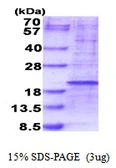 Human RPL35 protein, His tag. GTX68237-pro