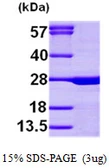 Human Calcium binding protein p22 protein, His tag. GTX68238-pro