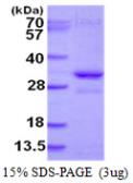 Human SNF8 protein, His tag. GTX68239-pro