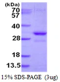 Human SNF8 protein, His tag. GTX68239-pro