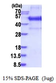 Human KLF12 protein, His tag. GTX68240-pro