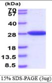 Human Park7 / DJ-1 protein, His tag. GTX68242-pro