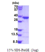 Human COPE protein, His tag. GTX68243-pro