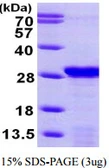 Human Acid Phosphatase protein, His tag. GTX68247-pro